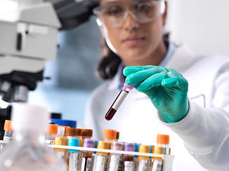 Laboratory test tubes